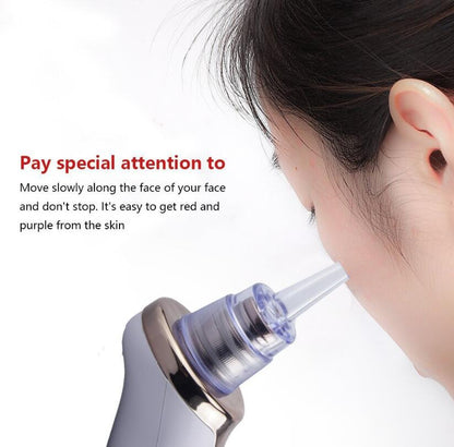 Blackhead Instrument Electric Suction Facial Washing hair removal exfoliating tool