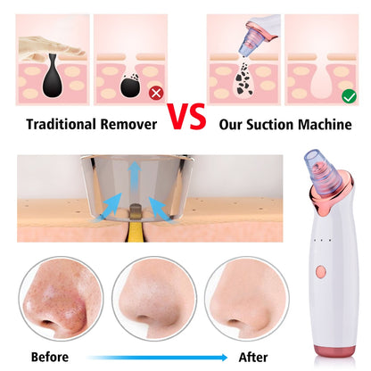 Blackhead Instrument Electric Suction Facial Washing hair removal exfoliating tool