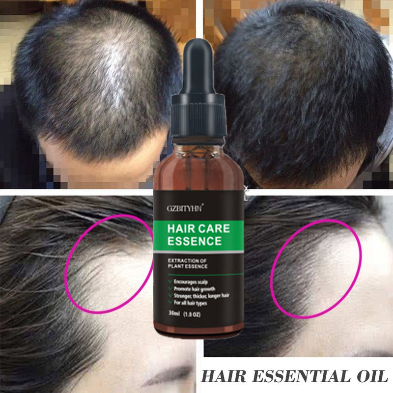 Hair Growth Oil Hair Growth Oil hair removal exfoliating tool