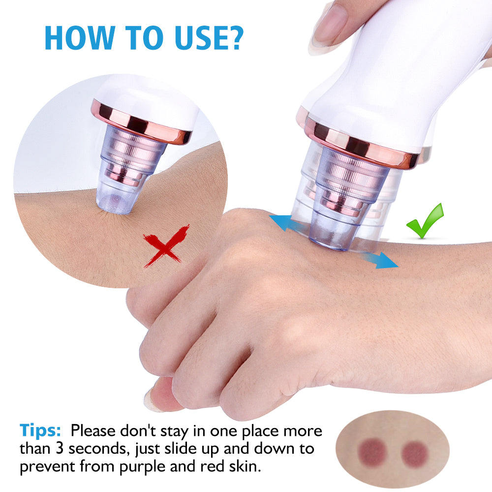 Blackhead Instrument Electric Suction Facial Washing hair removal exfoliating tool