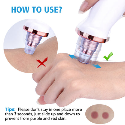Blackhead Instrument Electric Suction Facial Washing hair removal exfoliating tool
