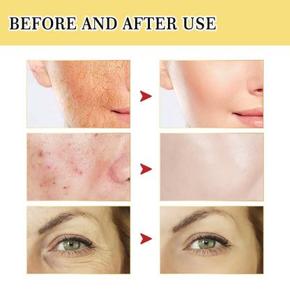Snail Serum Collagen Facial Serum Original hair removal exfoliating tool
