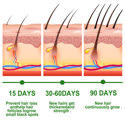 Rosemary Anti Breakage Nourishing Hair Care hair removal exfoliating tool